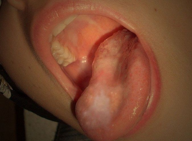 Sex seznamka, Ona hled� jeho - Hlubok� or�l, 28 let, kraj: Jihomoravsk�